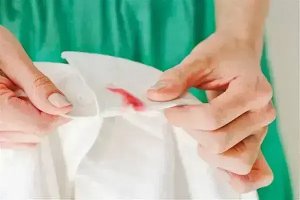 Como tirar mancha de roupa branca de forma prática